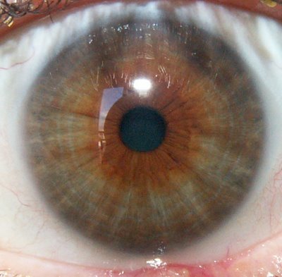 Iridología. Iris de buena densidad Iridología. Iris de buena densidad